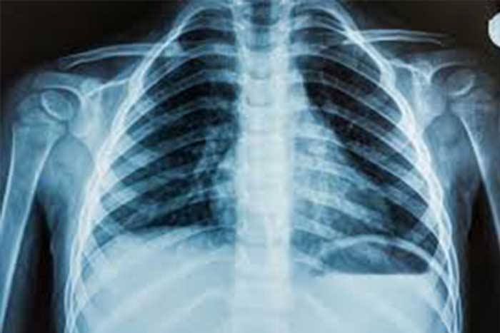 x ray